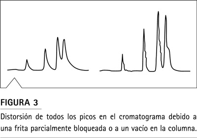 Cromatografía de Fase Reversa