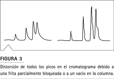 Figura 3: distorsión generalizada de picos en HPLC por frita bloqueada o vacío en cabeza de columna