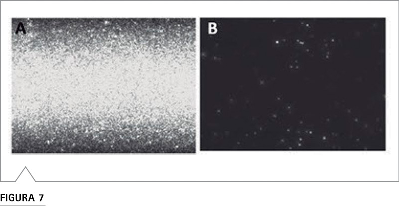 Nanosight NTA mostrando liposomas fluorescentes en suero fetal bovino en modo dispersión y modo fluorescencia