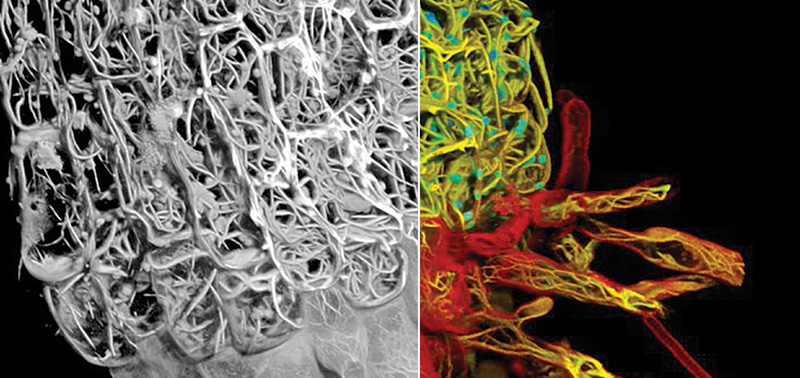 TauGating STELLARIS fluorescencia indeseada señales no específicas microscopía confocal