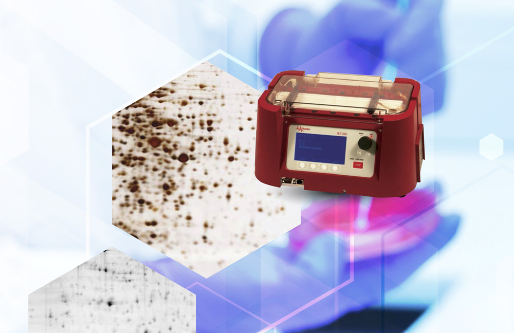 isoelectroenfoque con tiras de gel IPG