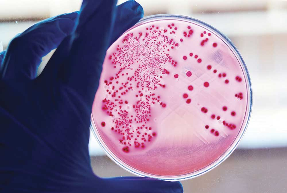 Test de endotoxinas bacterianas